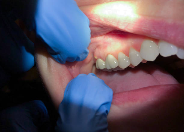 Best Broken Tooth Emergency  in Grape Creek, TX